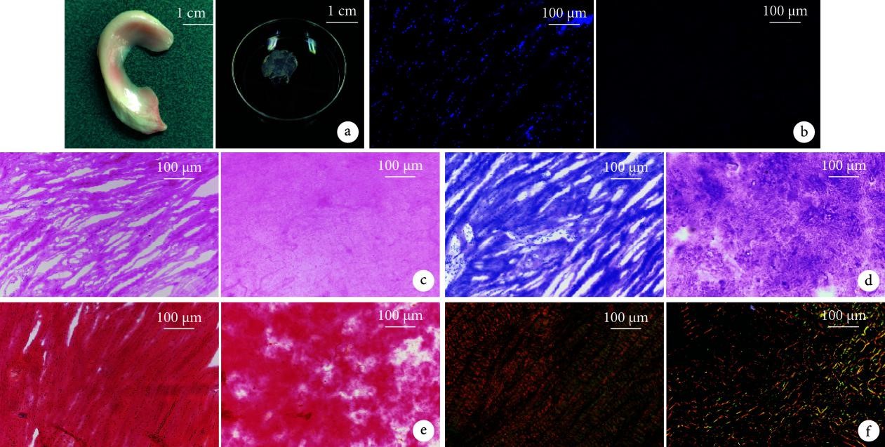 CJPRS|首都醫(yī)科大學(xué)附屬北京積水潭醫(yī)院矯形骨科陳明學(xué)醫(yī)生基于低溫沉積 3D 打印技術(shù)構(gòu)建新型組織工程半月板支架的研究
