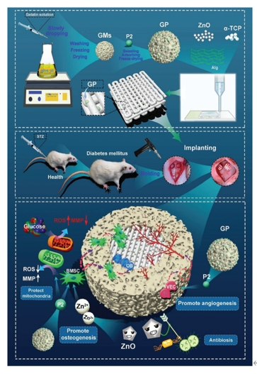 高活性肽-金屬離子-骨水泥三重整合3D打印復(fù)合支架促進(jìn)糖尿病骨缺損的骨血管再生修復(fù)
